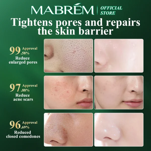 MABREM Pomegranate Fine Pores Face Serum Whitening Plant Skin Care Anti Aging Anti Wrinkle Cream Reduce Acne Marks Care 10ml - Image 2